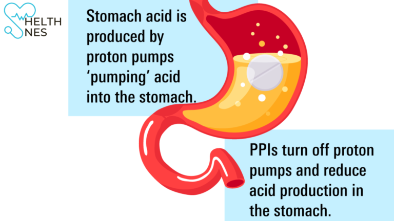 Lansoprazole Side Effects