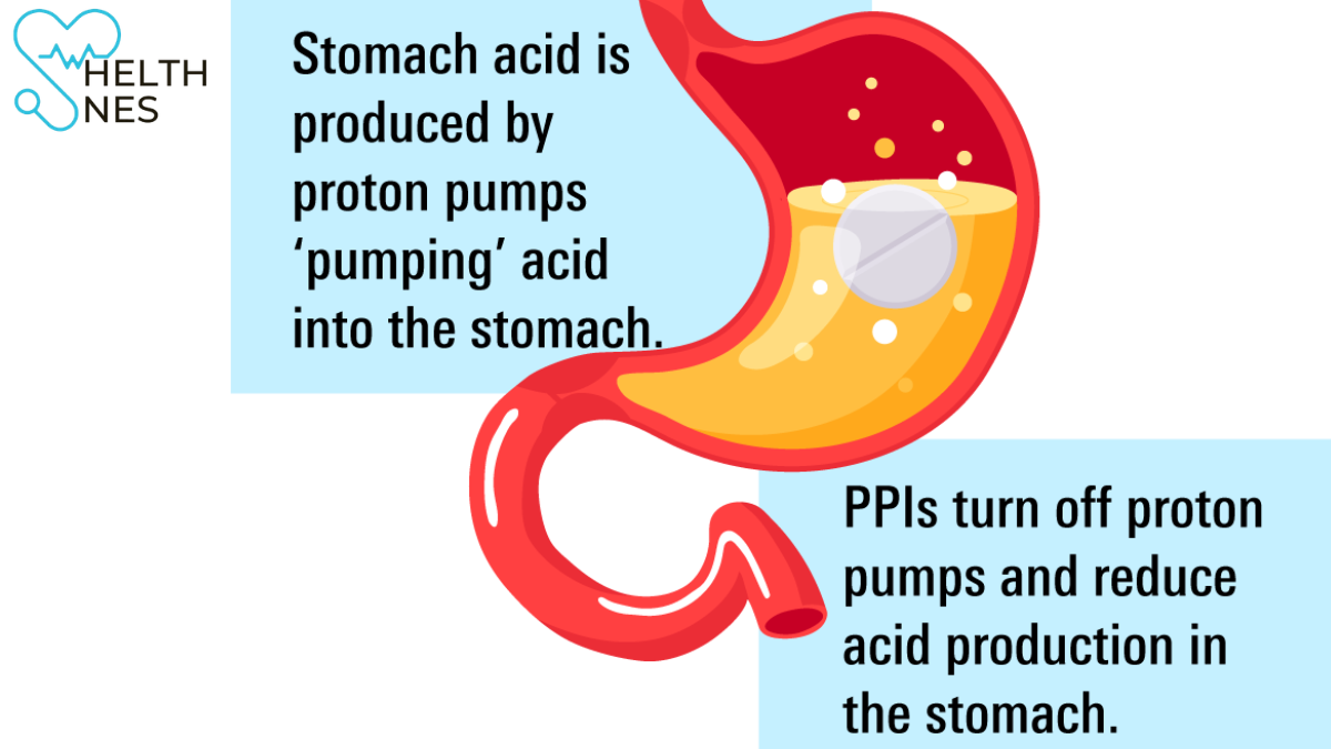 Lansoprazole Side Effects