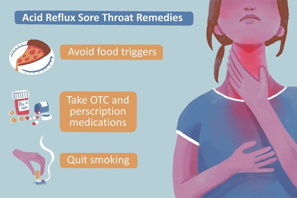 Acid Reflux Relief Tips