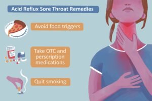 Acid Reflux Relief Tips