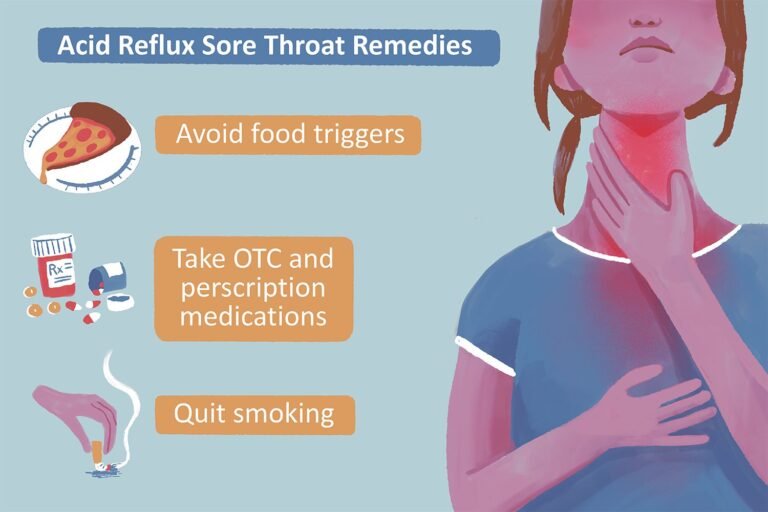 Acid Reflux Relief Tips