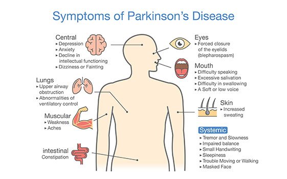 Early Onset Symptoms Guide