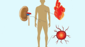 Prevent Diabetes Complications Long Term Effects of Diabetes