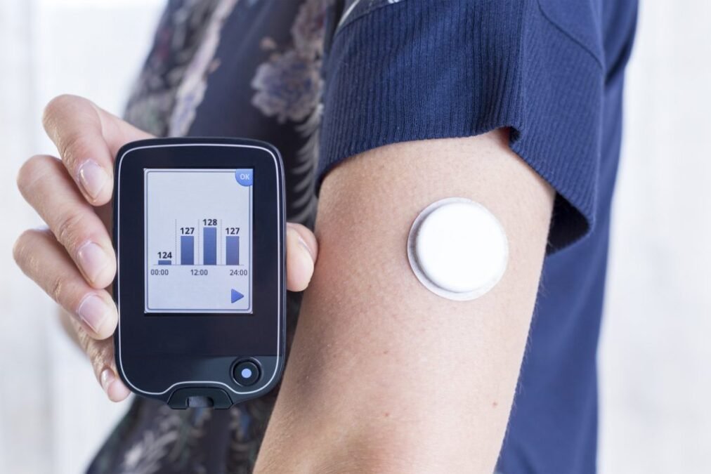 Continuous Glucose Monitor Benefits Continuous Glucose Monitor Benefits