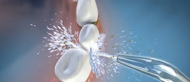 Waterpik Water Flosser